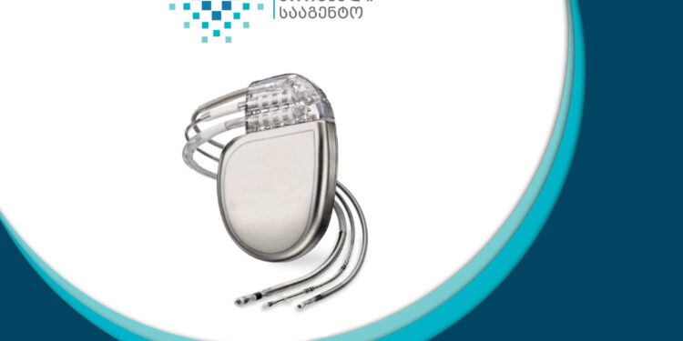 ჯანმრთელობის ეროვნულმა სააგენტომ კარდიოვერტერ-დეფიბრილატორების უსასყიდლოდ გაცემა დაიწყო
